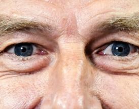 Un primo piano strettissimo di Jürgen Klinsmann!